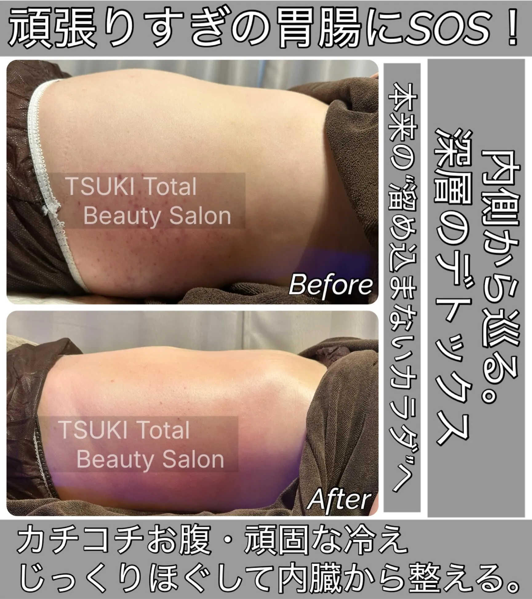 【自分のお腹、これが「普通」だと思っていませんか?】